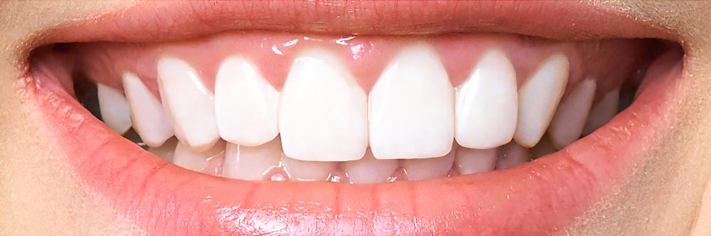 teeth-01 | Divi Pixel